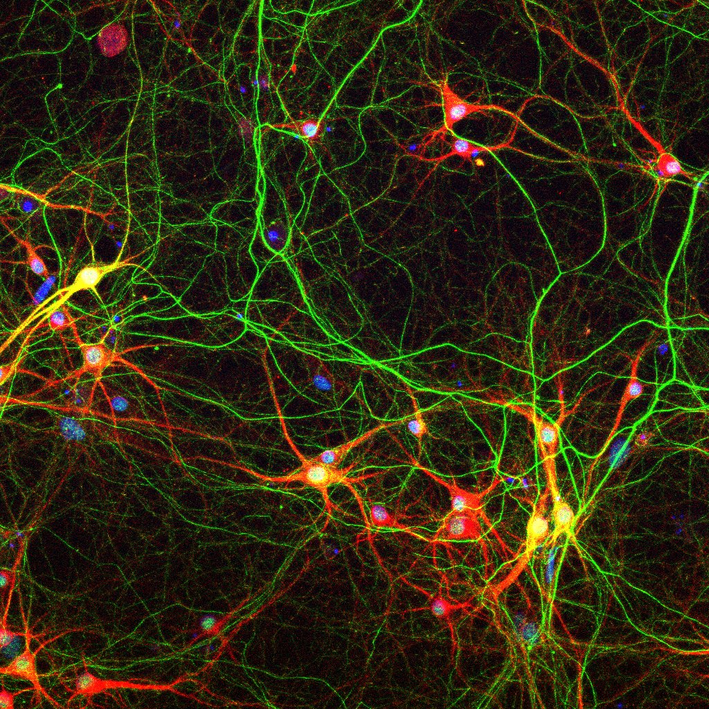 Hippocampal culture microscopy image
