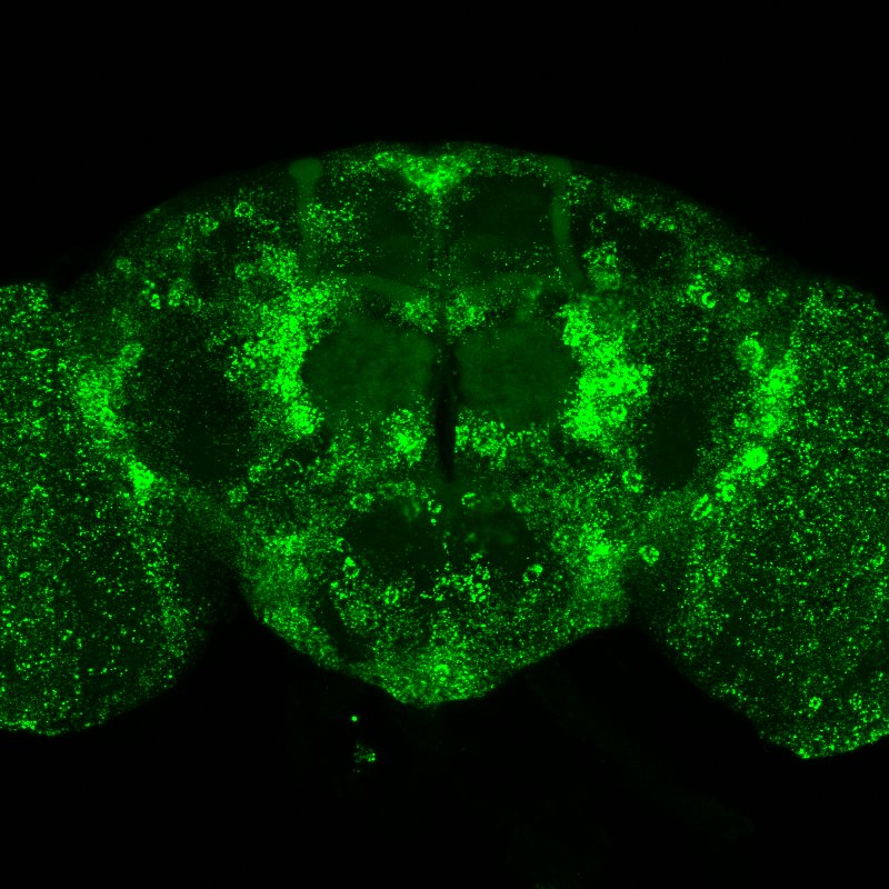 EGFP microscopy image