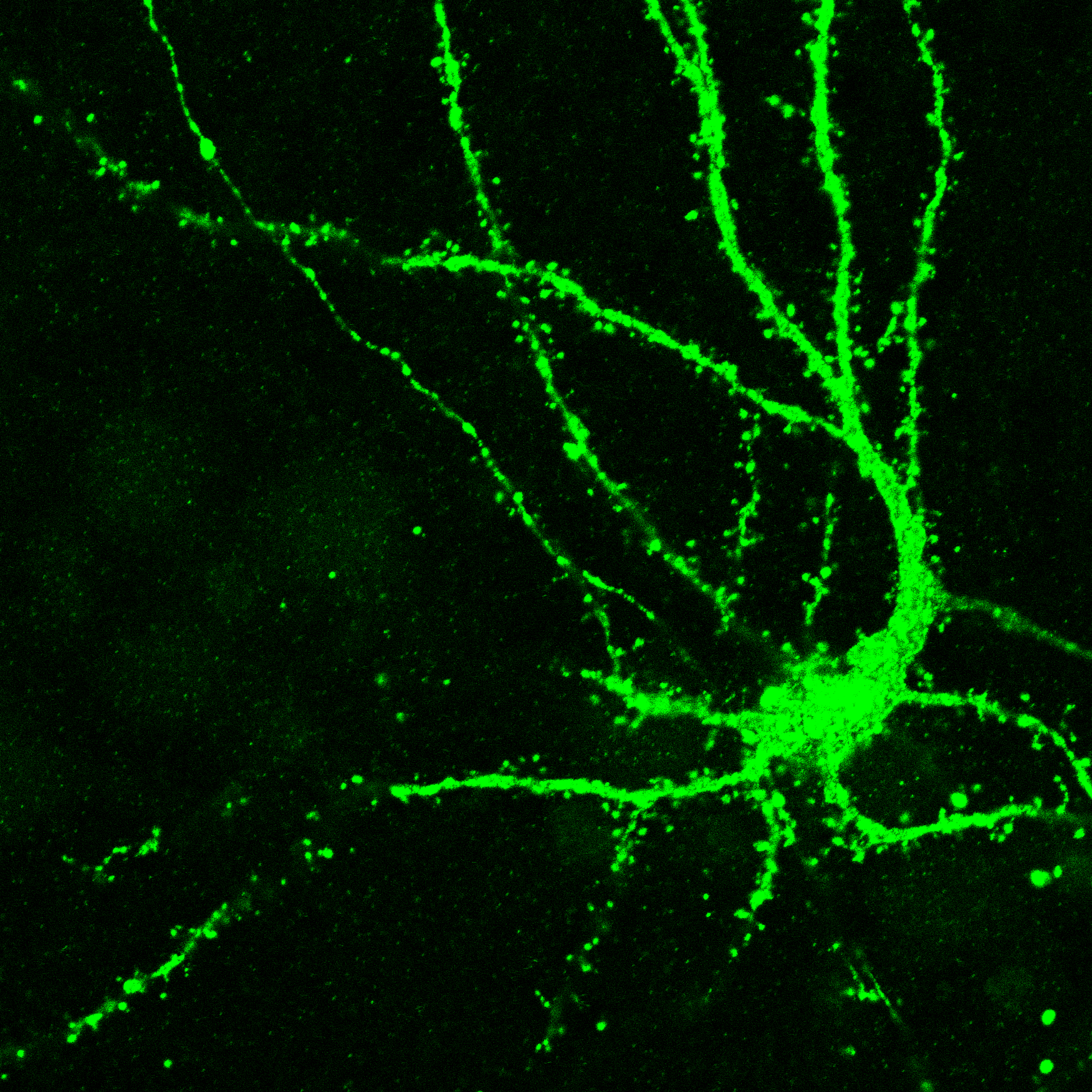 Rat hippocampal neuron GFP image
