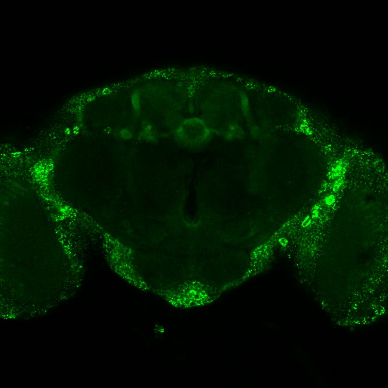 Slice EGFP microscopy image